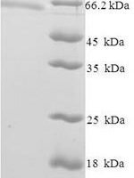 Human Zinc finger and SCAN domain-containing protein 20 (ZSCAN20) Recombinant Protein - BioCrest Sci