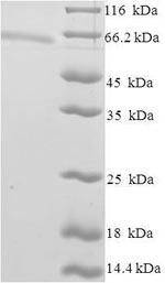 Human Zinc finger and SCAN domain-containing protein 20 (ZSCAN20) Recombinant Protein, Homo sapiens (Human), E.coli, N-terminal 6xHis-SUMO-tagged, 65.0 kDa, purity >≥ 90% as determined by SDS-PAGE.