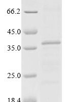 Mouse Beta-tectorin (Tectb) Recombinant Protein - BioCrest Sci