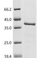 Rotavirus A Outer capsid glycoprotein VP7 Recombinant Protein, C-His - BioCrest Sci