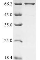 Human Coiled-coil domain-containing protein 174 (CCDC174) Recombinant Protein - BioCrest Sci