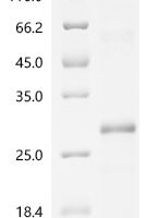 Human Tumor necrosis factor receptor superfamily member 3 (LTBR), partial Recombinant Protein, N-His, aa 31–227, MW 25.8 kDa - BioCrest Sci