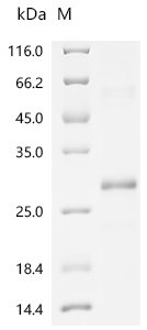 Human Tumor necrosis factor receptor superfamily member 3 (LTBR), partial Recombinant Protein, N-His, aa 31–227, MW 25.8 kDa, Homo sapiens (Human), E.coli, N-terminal 6xHis-tagged, 25.8 kDa, purity >≥ 90% as determined by SDS-PAGE.≥ 90% as determined by SEC-HPLC.