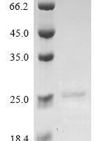 Mouse Apoptosis-associated speck-like protein containing a CARD (Pycard), partial Recombinant Protein - BioCrest Sci