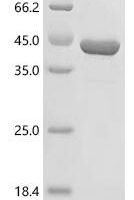 Cyberlindnera jadinii Uricase Recombinant Protein - BioCrest Sci