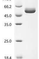 Human Interleukin-6 (IL6),Biotinylated Recombinant Protein - BioCrest Sci