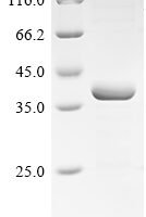 Lake Victoria marburgvirus Polymerase cofactor VP35 (VP35) Recombinant Protein - BioCrest Sci