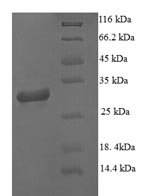 Human Microtubule-associated protein 1S (MAP1S), partial Recombinant Protein - BioCrest Sci
