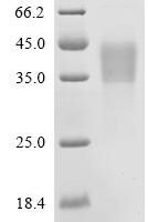 Human Leucine-rich repeat-containing G-protein coupled receptor 4 (LGR4), partial Recombinant Protein, C-10His - BioCrest Sci