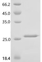 Human T-cell acute lymphocytic leukemia protein 1 (TAL1), partial Recombinant Protein, N-His-SUMO - BioCrest Sci