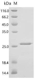 Human T-cell acute lymphocytic leukemia protein 1 (TAL1), partial Recombinant Protein, N-His-SUMO, E.coli, N-terminal 6xHis-SUMO-tagged, 21.7 kDa, purity >≥ 85% as determined by SDS-PAGE.