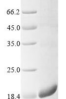 Mouse Serine protease inhibitor Kazal-type 2 (Spink2) Recombinant Protein - BioCrest Sci
