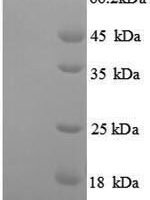 Thermus aquaticus DNA polymerase I, thermostable (polA), partial Recombinant Protein, Tag-Free - BioCrest Sci