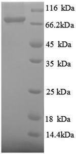 Thermus aquaticus DNA polymerase I, thermostable (polA), partial Recombinant Protein, Tag-Free, Thermus aquaticus, E.coli, Tag-Free, 62.3 kDa, purity >≥ 90% as determined by SDS-PAGE.