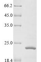 Human Insulin-like growth factor 1 receptor (IGF1R), partial Recombinant Protein, N-10His - BioCrest Sci