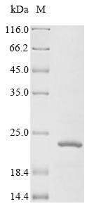 Human Insulin-like growth factor 1 receptor (IGF1R), partial Recombinant Protein, N-10His, Homo sapiens (Human) parvovirus B19 (isolate AU) (HPV B19), Mammalian cell, N-terminal 10xHis-tagged, 21.9 kDa, purity >≥ 85% as determined by SDS-PAGE.