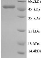 Mouse Isocitrate dehydrogenase [NADP] Cytoplasmic domain (Idh1), partial Recombinant Protein - BioCrest Sci