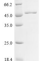 Human Poly [ADP-ribose] polymerase 1 (PARP11), partial Recombinant Protein - BioCrest Sci
