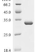 Escherichia coli Translation initiation factor IF-3 (infC) Recombinant Protein - BioCrest Sci