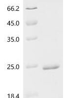 Saccharomyces cerevisiae Arginine permease CAN1 (CAN1), partial Recombinant Protein - BioCrest Sci