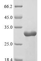 Danio rerio Interleukin-1 (il1b) Recombinant Protein - BioCrest Sci
