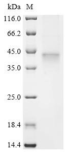 Human Probable threonine protease PRSS50 (PRSS50) Recombinant Protein, Homo sapiens (Human), Baculovirus, C-terminal 6xHis-tagged, 41.7 kDa, purity >≥ 85% as determined by SDS-PAGE.