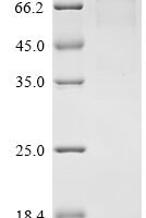 Mouse Neuronal pentraxin-1 (Nptx1), partial Recombinant Protein - BioCrest Sci