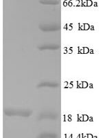 Human 39S ribosomal protein L54, mitochondrial (MRPL54) Recombinant Protein - BioCrest Sci