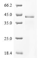 Human Protein sprouty homolog 2 (SPRY2) Recombinant Protein - BioCrest Sci