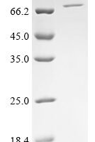 Human Poly [ADP-ribose] polymerase 2 (PARP2) Recombinant Protein, N-His, aa 1–583, Baculovirus - BioCrest Sci