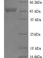 Bovine Serpin A3-2 (SERPINA3-2) Recombinant Protein - BioCrest Sci