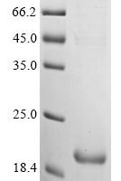 Bovine G-protein coupled receptor 52 (GPR52), partial Recombinant Protein - BioCrest Sci