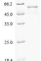 Human Butyrophilin-like protein 2 (BTNL2), Partial Recombinant Protein, C-His, Isoform 1 - BioCrest Sci