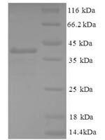 Human Gamma-aminobutyric acid receptor-associated protein-like 2 (GABARAPL2) Recombinant Protein - BioCrest Sci