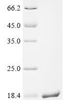 Rat Sodium-dependent dopamine transporter (Slc6a3), partial Recombinant Protein - BioCrest Sci
