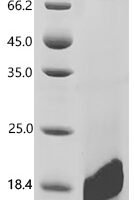 Human Lymphocyte antigen 6D (LY6D) Recombinant Protein, C-10His - BioCrest Sci