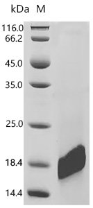 Human Lymphocyte antigen 6D (LY6D) Recombinant Protein, C-10His, Mammalian cell, C-terminal 10xHis-tagged, 9.8 kDa, purity >≥ 95% as determined by SDS-PAGE.