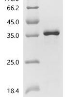 Thermoplasma acidophilum Tricorn protease (tri), partial Recombinant Protein - BioCrest Sci