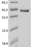 Human Aspartoacylase (ASPA) Recombinant Protein, C-His - BioCrest Sci