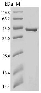 Human Aspartoacylase (ASPA) Recombinant Protein, C-His, E.coli, C-terminal 6xHis-tagged, 42.6 kDa, purity >≥ 90% as determined by SDS-PAGE.
