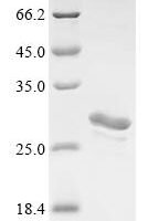 Human Agrin (AGRN), partial Recombinant Protein - BioCrest Sci