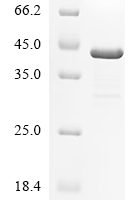 Human herpesvirus 1 Capsid vertex component 2 (CVC2), partial Recombinant Protein - BioCrest Sci