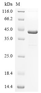 Human herpesvirus 1 Capsid vertex component 2 (CVC2), partial Recombinant Protein, Human herpesvirus 1 (strain 17) (HHV-1) (Human herpes simplex virus 1), E.coli, N-terminal 10xHis-tagged and C-terminal Myc-tagged, 43.8 kDa, purity >≥ 85% as determined by SDS-PAGE.
