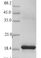 Rat Frataxin, mitochondrial (Fxn) Recombinant Protein, Tag-Free - BioCrest Sci