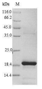 Rat Frataxin, mitochondrial (Fxn) Recombinant Protein, Tag-Free, Rattus norvegicus (Rat), E.coli, Tag-Free, 18.6 kDa, purity >≥ 90% as determined by SDS-PAGE.