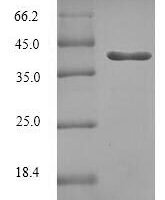 Human Ras-related protein Rab-5C (RAB5C) Recombinant Protein, N-His-SUMO - BioCrest Sci