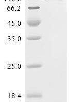 Mouse Focal adhesion kinase 1 (Ptk2), partial Recombinant Protein, C-10His-HSA - BioCrest Sci