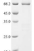 Human F-box/WD repeat-containing protein 11 (FBXW11) Recombinant Protein - BioCrest Sci