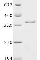 Paramacrobiotus richtersi Cytosolic-abundant heat soluble protein 106094 (CAHS 106094) Recombinant Protein - BioCrest Sci