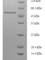 Streptomyces caespitosus Modification methylase ScaI (scaIM) Recombinant Protein - BioCrest Sci